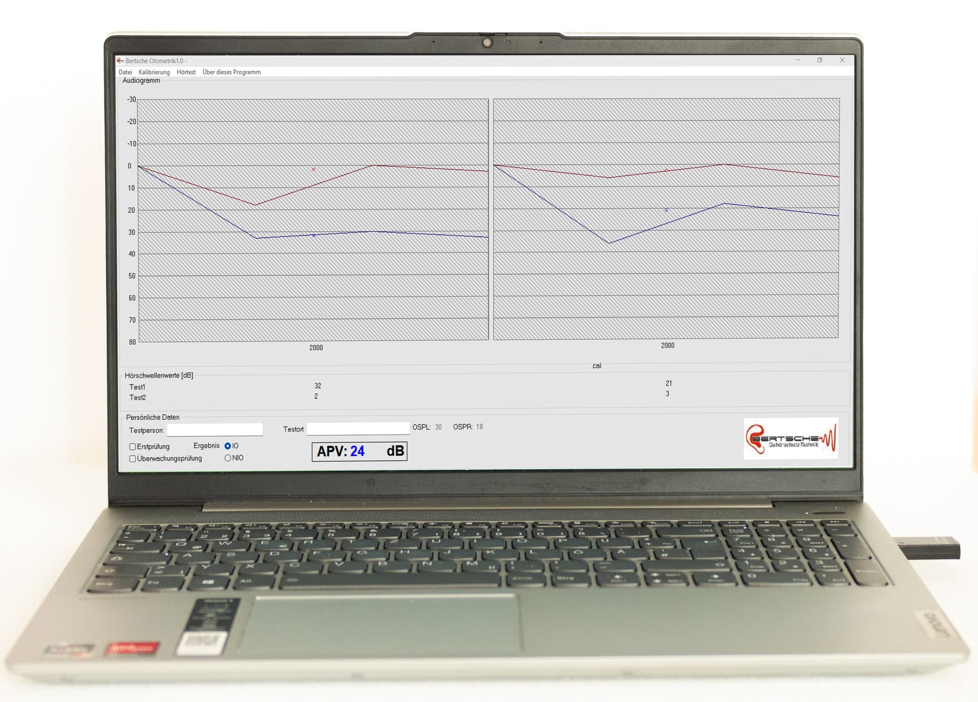 audiometry test computer screen